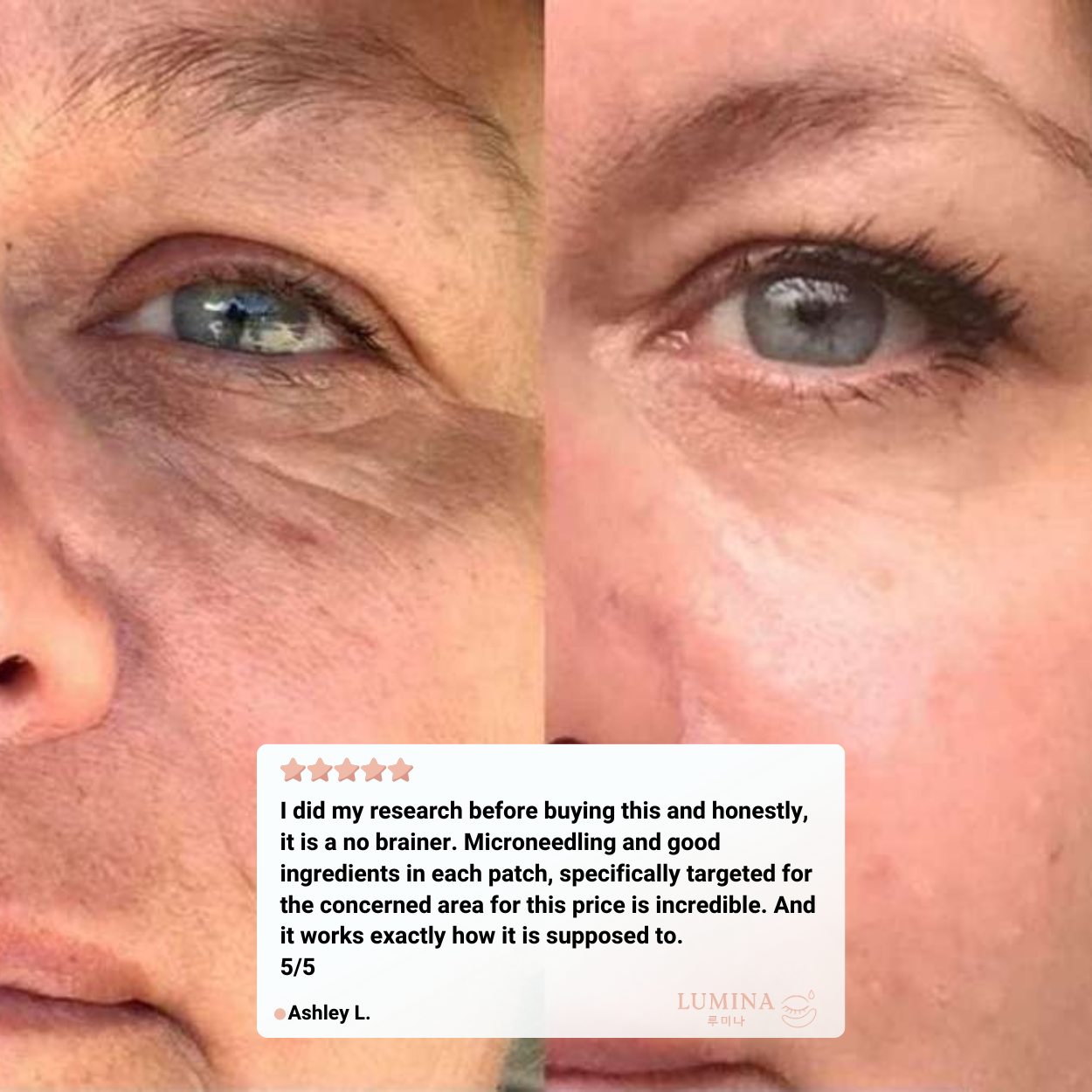 Revivex Infusion Under-Eye Patches™