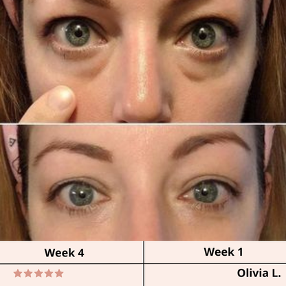 Revivex Infusion Under-Eye Patches™