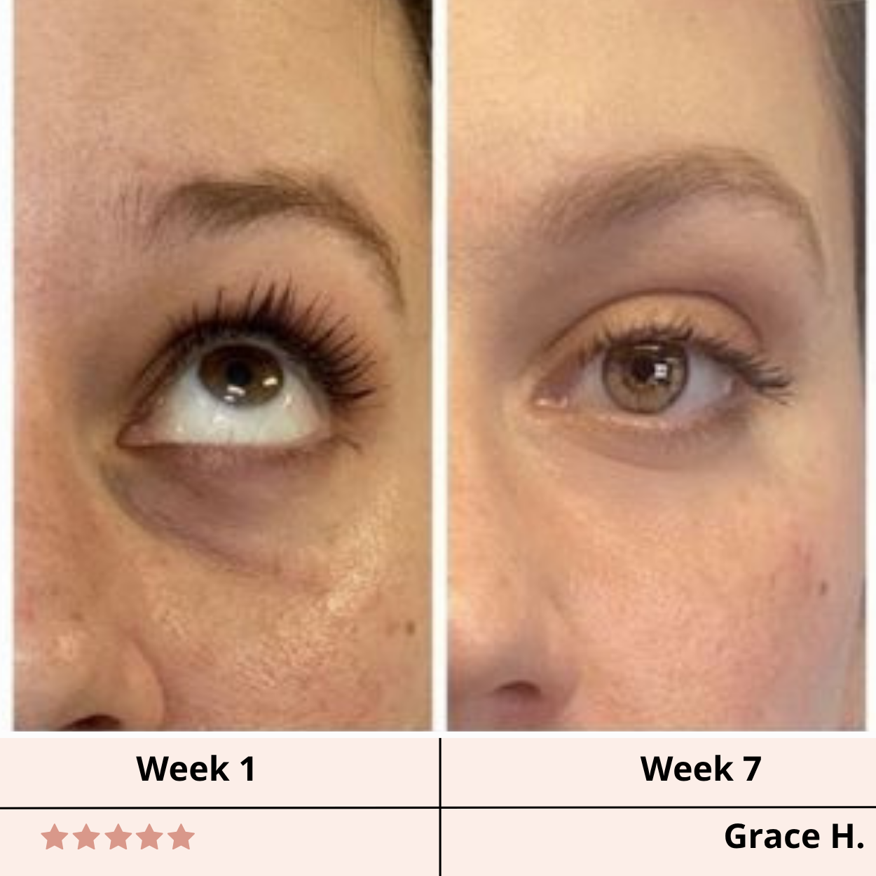 Revivex Infusion Under-Eye Patches™